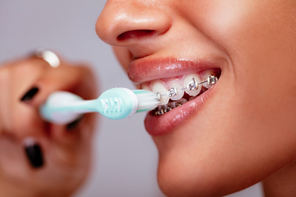 Oral Hygiene With Braces in Worcester, MA