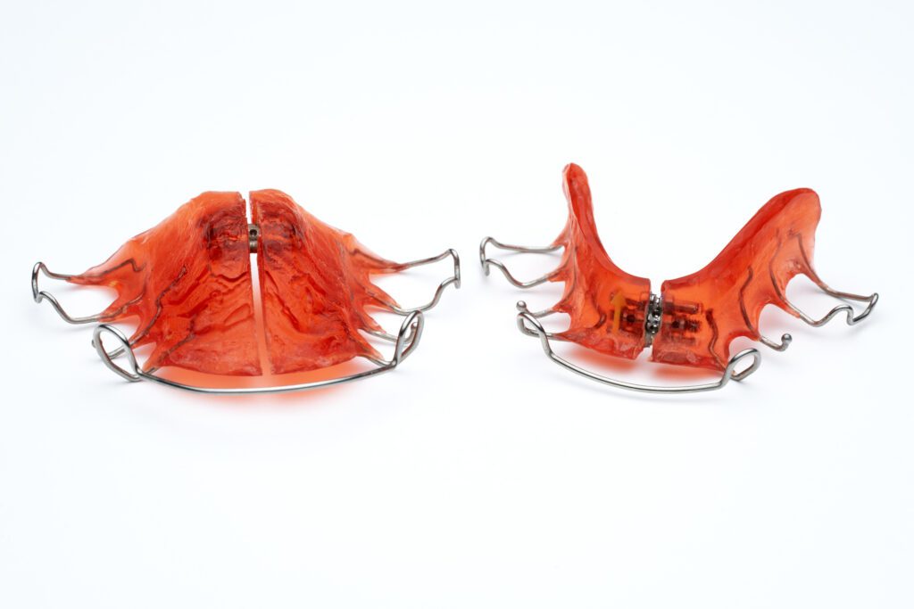 Orthodontic Appliances in Worcester, MA